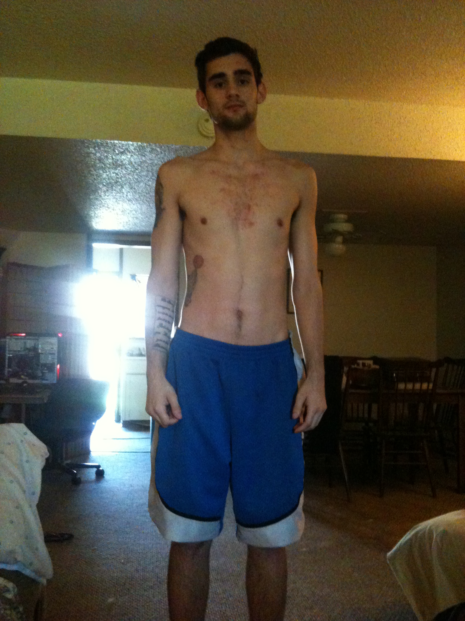 This is me the day i decided to come clean and get sober I lost 30 pounds in 6 months it tore THREW me with pure evil 