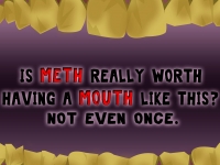 meth mouth